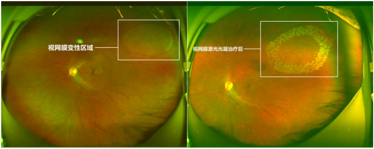 c04cb98bf525c066d43c7a60b929112b