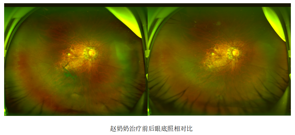 d65a8294827ad70a01dfab0846024ef9